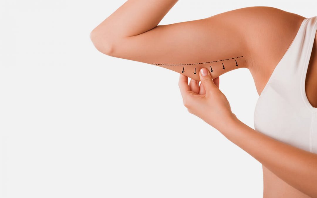 How to choose an Arm and hip fat removal surgeon in London?