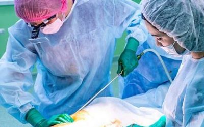 Liposuction surgeries have rising result rates for successful implementation