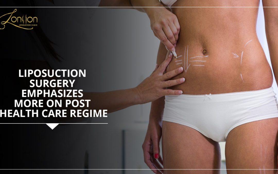 Liposuction surgery emphasizes more on Post health care regime