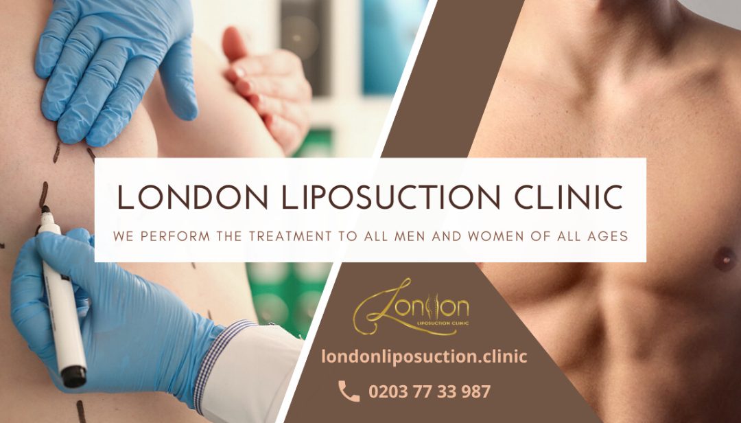Liposuction surgery is No more a worry
