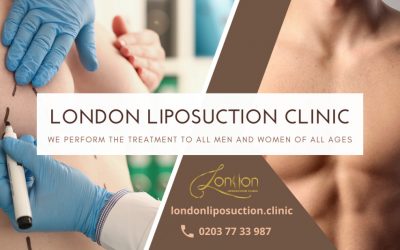 Liposuction surgery is No more a worry