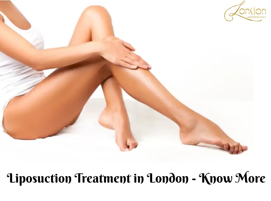 Liposuction Treatment in London – Know more.