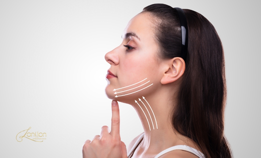 Liposuction in London: Achieve a Defined Chin & Neck Today