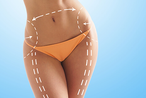 Liposuction Cost in London: Hidden Recovery Expenses